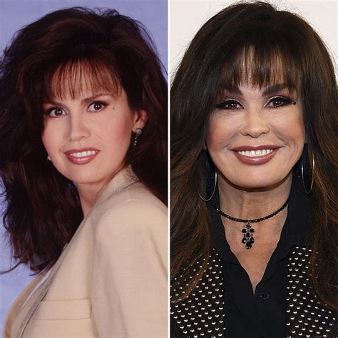 marie osmond had plastic surgery